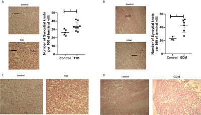 FKBPL and SIRT-1 Are Downregulated by Diabetes in Pregnancy Impacting on Angiogenesis and Endothelial Function